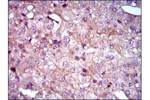 Image no. 1 for anti-Sonic Hedgehog (SHH) antibody (ABIN1491290) (Sonic Hedgehog Antikörper)