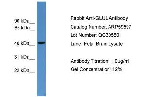 WB Suggested Anti-GLUL  Antibody Titration: 0. (GLUL Antikörper  (C-Term))