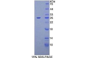 SDS-PAGE analysis of Human CA125 Protein. (MUC16 Protein)