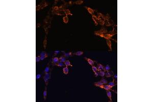 Immunofluorescence (IF) image for anti-P450 (Cytochrome) Oxidoreductase (POR) (AA 1-250) antibody (ABIN6145969)