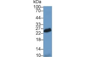 Detection of NCR2 in Rat Spleen lysate using Polyclonal Antibody to Natural Cytotoxicity Triggering Receptor 2 (NCR2) (NKp44/NCR2 Antikörper  (AA 22-120))