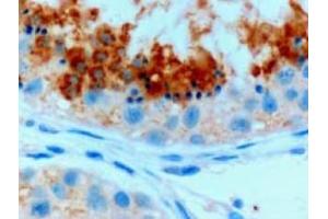 Image no. 1 for anti-Glutathione Peroxidase 4 (GPX4) (C-Term), (Isoform A) antibody (ABIN374711) (GPX4 Antikörper  (C-Term, Isoform A))