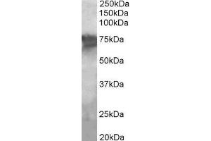 ABIN2564412 (2µg/ml) staining of Human Liver lysate (35µg protein in RIPA buffer). (PEPCK Antikörper  (Internal Region))