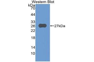 Western blot analysis of the recombinant protein. (ADAM8 Antikörper  (AA 371-587))