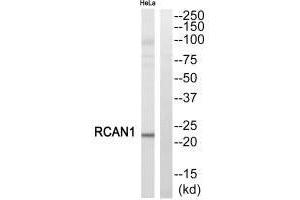 Western blot analysis of extracts from HeLa cells, using RCAN1 antibody. (RCAN1 Antikörper  (C-Term))