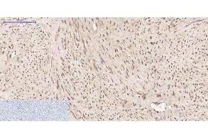 Immunohistochemistry of paraffin-embedded Human uterus tissue using PPIB Monoclonal Antibody at dilution of 1:200. (PPIB Antikörper)