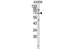Western blot analysis of EWSR1 Antibody (C-term) in A2058 cell line lysates (35ug/lane). (EWSR1 Antikörper  (C-Term))
