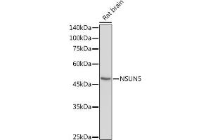 Western blot analysis of extracts of Rat brain, using NSUN5 antibody (ABIN7268955) at 1:1000 dilution. (NSUN5 Antikörper  (AA 277-466))