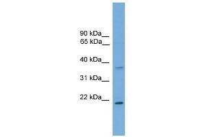 GSTM1 antibody used at 0.