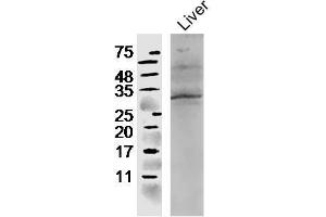 Mouse liver lysates probed with Rabbit Anti-CCL4 Polyclonal Antibody, Unconjugated  at 1:300 in 4˚C overnight. (CCL4 Antikörper  (AA 26-92))