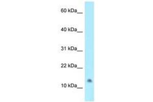 Image no. 1 for anti-N-Acetyltransferase 8-Like (GCN5-Related, Putative) (NAT8L) (C-Term) antibody (ABIN6747980)