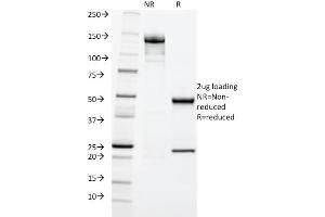 SDS-PAGE (SDS) image for anti-Keratin 20 (KRT20) (AA 196-323) antibody (ABIN6940347)