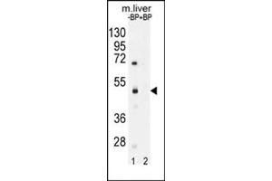 Western blot analysis of SAMD8 Antibody (N-term) Cat. (SAMD8 Antikörper  (N-Term))
