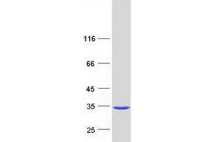 Validation with Western Blot