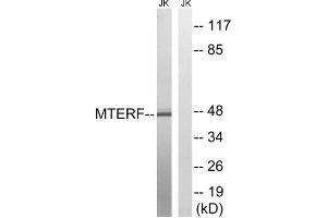 Western blot analysis of extracts from Jurkat cells, using MTERF antibody. (MTERF Antikörper  (Internal Region))