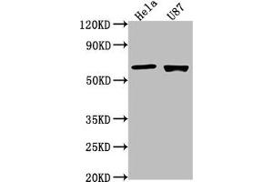 Western Blot Positive WB detected in: Hela whole cell lysate, U87 whole cell lysate All lanes: USP17L1 antibody at 1:2000 Secondary Goat polyclonal to rabbit IgG at 1/50000 dilution Predicted band size: 60 kDa Observed band size: 60 kDa (USP17L1 Antikörper  (C-Term))