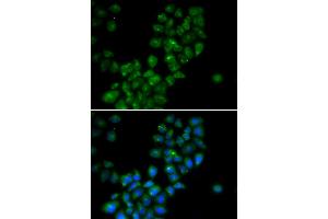 Immunofluorescence analysis of HeLa cells using CANT1 antibody (ABIN5973753). (CANT1 Antikörper)