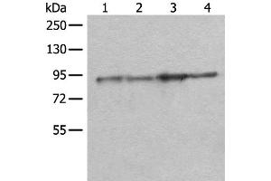 Western blot analysis of Rat brain tissue Mouse brain tissue A549 and PC-3 cell lysates using DDX1 Polyclonal Antibody at dilution of 1:300 (DDX1 Antikörper)