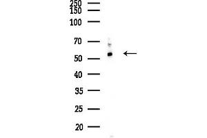 anti-3-Hydroxy-3-Methylglutaryl-CoA Synthase 1 (Soluble) (HMGCS1) (Internal Region) antibody