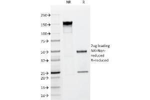 SDS-PAGE Analysis Purified FGF23 Mouse Monoclonal antibody (FGF23/638). (FGF23 Antikörper)