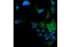 Image no. 2 for anti-Cancer/testis Antigen 1B (CTAG1B) antibody (ABIN1499900) (CTAG1B Antikörper)