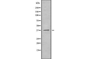 Western blot analysis of B3GALT6 using HuvEc whole cell lysates (B3GALT6 Antikörper  (Internal Region))