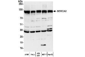 Western Blotting (WB) image for anti-ATPase, Ca++ Transporting, Cardiac Muscle, Slow Twitch 2 (ATP2A2) (AA 475-525) antibody (ABIN7450723)