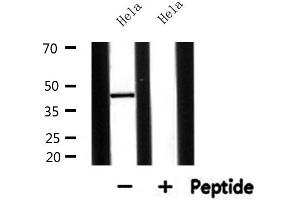 Western blot analysis of extracts from Hela, using AGPAT5 Antibody. (AGPAT5 Antikörper  (Internal Region))