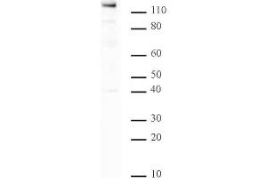 PARP-1 C-terminal antibody tested by Western blot. (PARP1 Antikörper  (C-Term))