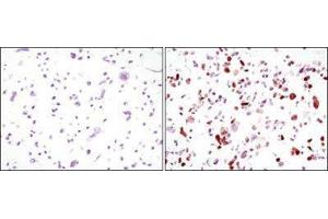 Immunohistochemistry (IHC) image for anti-Green Fluorescent Protein (GFP) antibody (ABIN1843725) (GFP Antikörper)