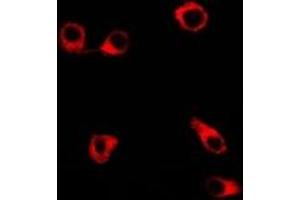 Immunofluorescent analysis of Clusterin staining in SW480 cells.