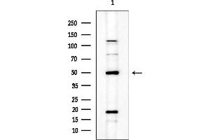 anti-Keratin 12 (KRT12) (Internal Region) antibody