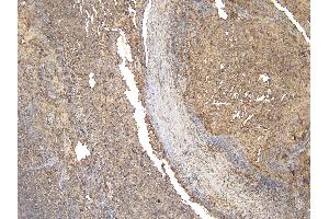 Immunohistochemistry (IHC) image for anti-Membrane-Spanning 4-Domains, Subfamily A, Member 1 (MS4A1) (C-Term) antibody (ABIN570905)