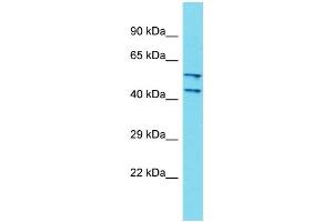 Host: Rabbit Target Name: DCAF4L2 Sample Type: Fetal Kidney lysates Antibody Dilution: 1.