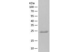 Western Blotting (WB) image for Nudix (Nucleoside Diphosphate Linked Moiety X)-Type Motif 16-Like 1 (NUDT16L1) (AA 1-211) protein (His tag) (ABIN7124241) (NUDT16L1 Protein (AA 1-211) (His tag))