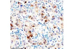 IHC analysis of Hsc70 using anti-Hsc70 antibody (ABIN7601962). (Hsc70 Antikörper  (AA 520-614))