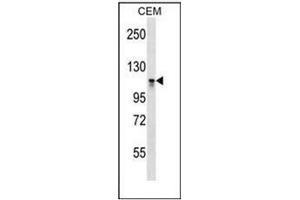 Western blot analysis of DNMT3A Antibody (C-term) in CEM cell line lysates (35ug/lane).