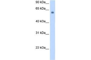 WB Suggested Anti-SLC1A4 Antibody Titration:  0. (SLC1A4 Antikörper  (C-Term))