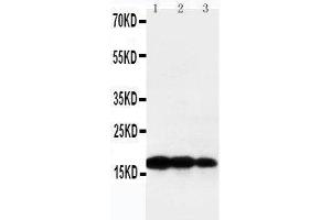 Anti-TNF beta antibody, Western blotting Lane 1: Recombinant Human TNF beta Protein 10ng Lane 2: Recombinant Human TNF beta Protein 5ng Lane 3: Recombinant Human TNF beta Protein 2. (LTA Antikörper  (Middle Region))