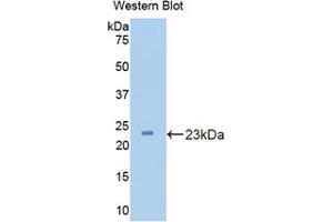 Western blot analysis of the recombinant protein. (CPN1 Antikörper  (AA 159-325))