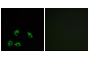 Immunofluorescence analysis of MCF-7 cells, using GPR103 antibody. (QRFPR Antikörper  (Internal Region))