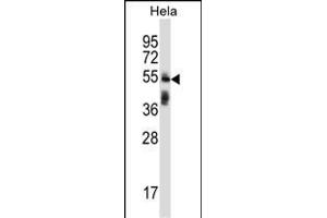 TRIM38 Antibody (C-term) (ABIN657328 and ABIN2846398) western blot analysis in Hela cell line lysates (35 μg/lane). (TRIM38 Antikörper  (C-Term))