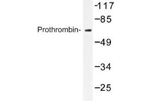 Image no. 1 for anti-Coagulation Factor II (thrombin) (F2) antibody (ABIN317606) (Prothrombin Antikörper)