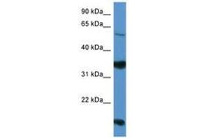 Image no. 1 for anti-Netrin G2 (NTNG2) (AA 199-248) antibody (ABIN6746812) (Netrin G2 Antikörper  (AA 199-248))