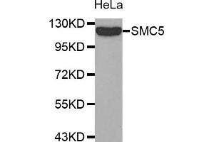 Western Blotting (WB) image for anti-Structural Maintenance of Chromosomes 5 (SMC5) antibody (ABIN1874872) (SMC5 Antikörper)