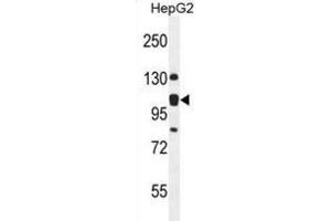 Western Blotting (WB) image for anti-KIAA0090 (KIAA0090) antibody (ABIN2995572) (KIAA0090 Antikörper)