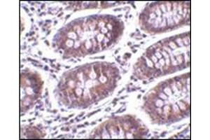 Immunohistochemistry of MICA in human colon tissue with this product at 10 μg/ml.