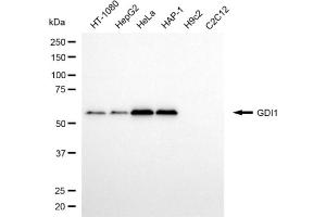 Western blotting analysis using GDI1 antibody (ABIN7798699).