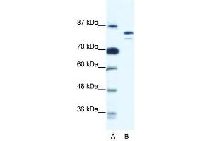 MCM8 antibody used at 0.