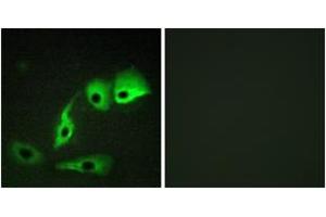 Immunofluorescence analysis of HepG2 cells, using Calmodulin (Ab-79/81) Antibody. (Calmodulin 1 Antikörper  (AA 46-95))